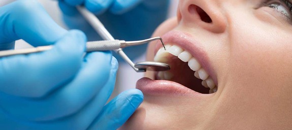 Лечение зубов и профилактика