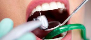 Пломбирование зубов