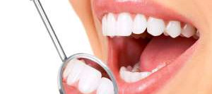 Удаление зубного камня