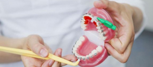Консультация стоматолога-ортодонта